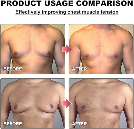 Men Therm - Bee Venom Gynecomastia Heating Oil